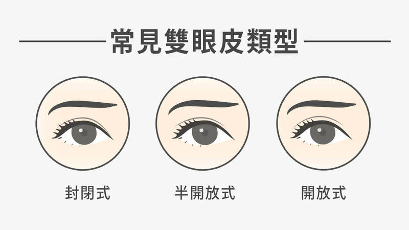 封閉式跟半開放式都是亞洲人中，較常見的雙眼皮類型，且因為亞洲人的眼窩與眉骨不像歐洲人那麼深邃，素顏狀態下較難駕馭開放式雙眼皮。