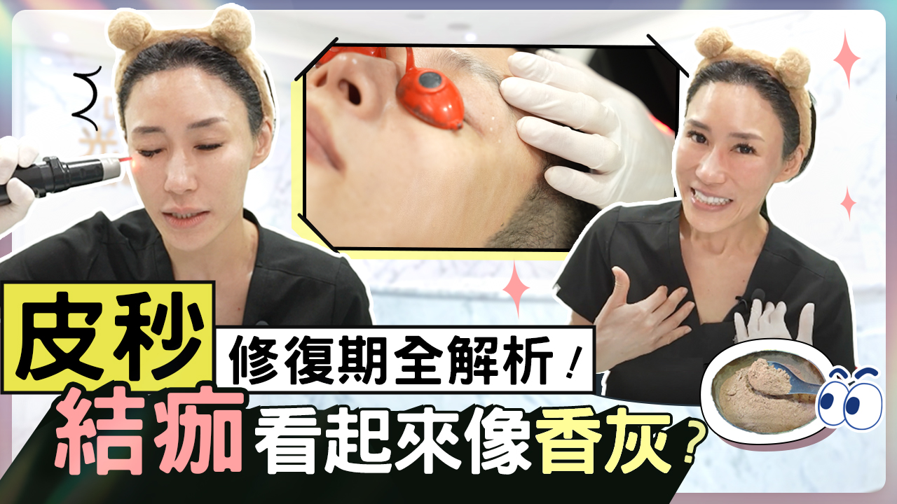 皮秒雷射術後修復期：結痂真相大解析！醫師膚況竟打不出結痂！？│郭千華醫師