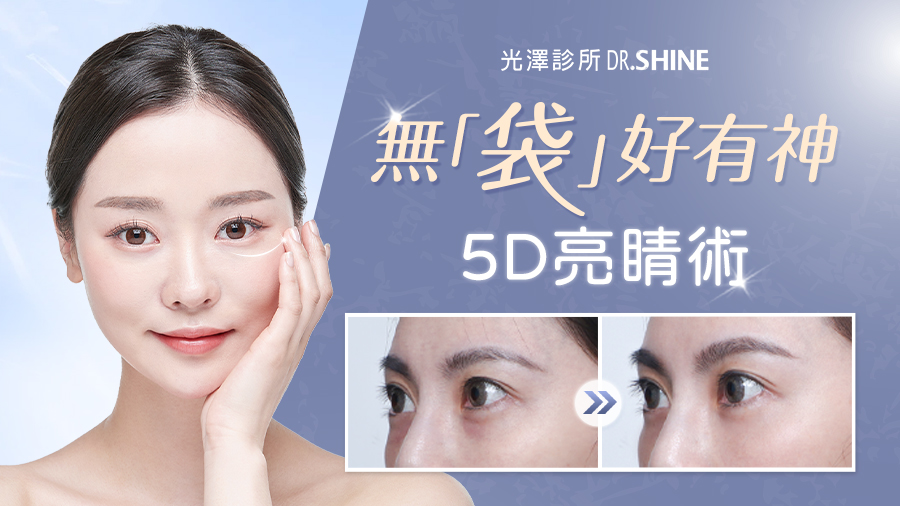 改善眼袋老態疲憊！「5D亮睛術」技術，解決眼部5大問題