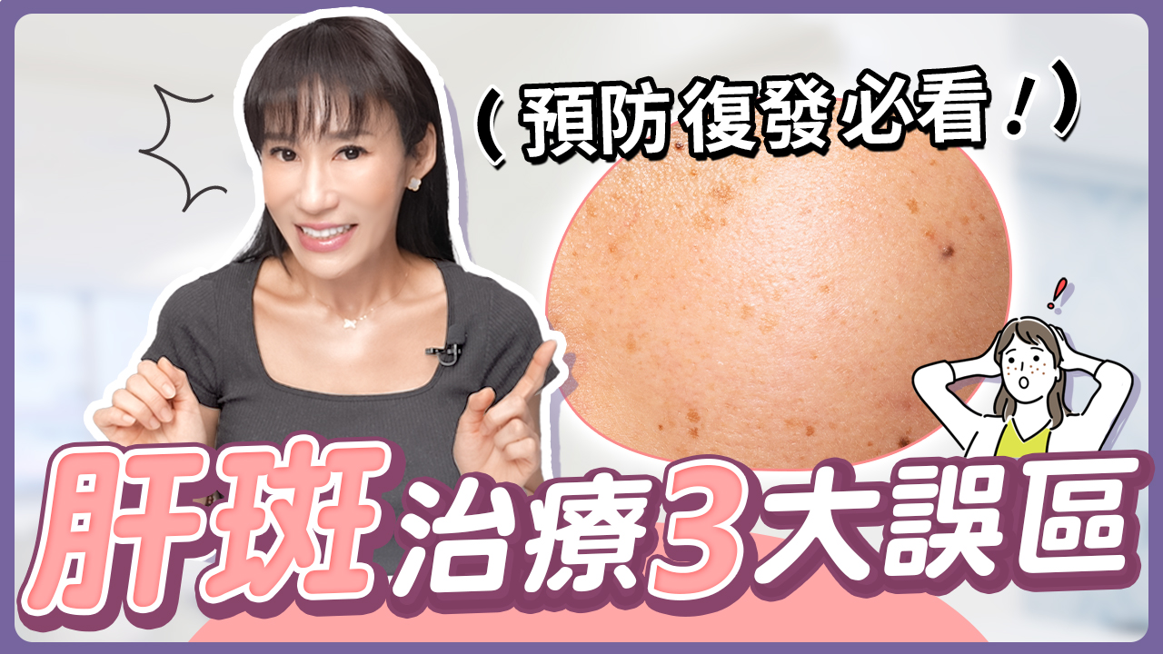 肝斑對決！保養品、藥物、雷射大解析，預防復發必看！│郭千華醫師