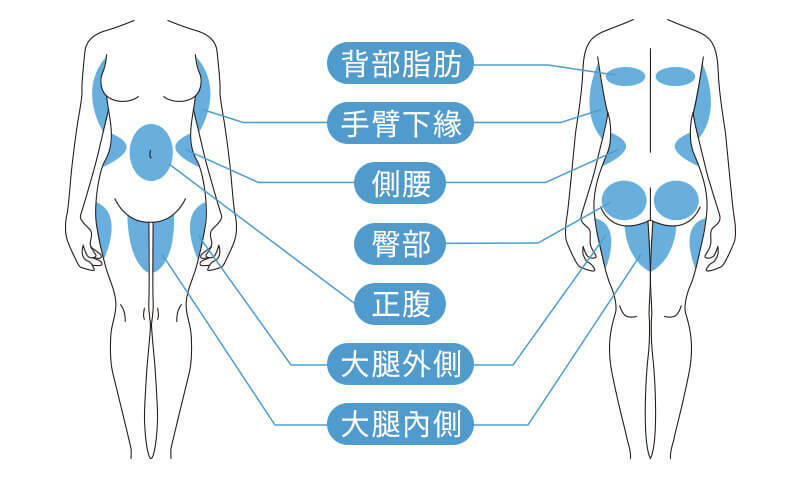 冷凍減脂適用部位圖