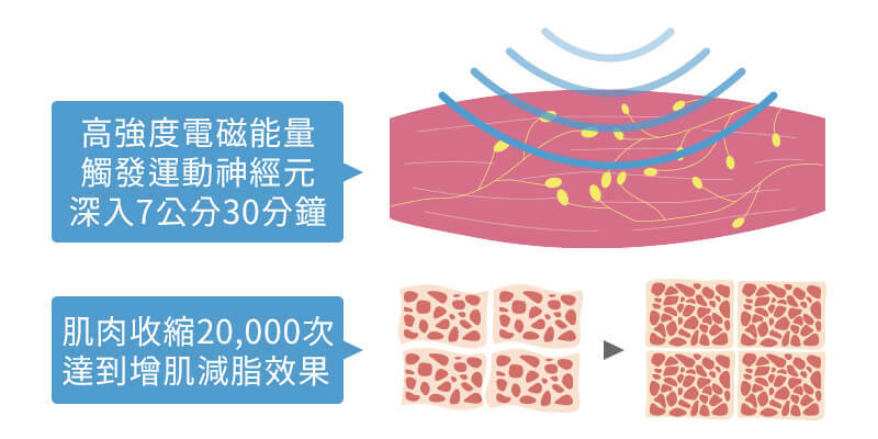 肌動減脂的作用原理在於高強度聚焦電磁能量的直接觸發運動神經元，在30分鐘使得肌肉能夠快速收縮20,000次，達到超極限肌肉收縮的程度