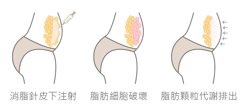 倍克脂_消脂針注射在皮下的脂肪堆積處，會破壞該部位的脂肪細胞，身體會自行代謝凋亡的脂肪顆粒並排出；約一週後開始消腫，一般建議三次為一個療程，每次治療需間隔4-6週，治療劑量則是依面積而定，並依不同脂肪分佈和治療目的而調整。