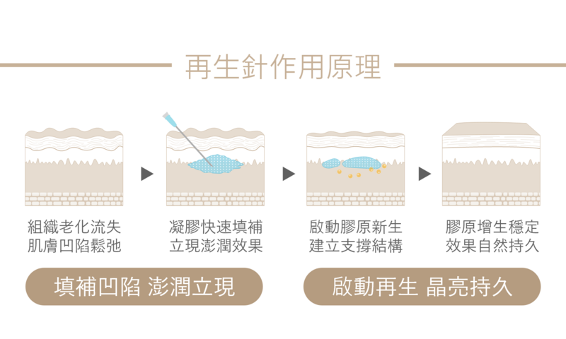 再生針，以其獨特的生物軟陶瓷技術，完美結合100%生物相容性和生物可分解性。