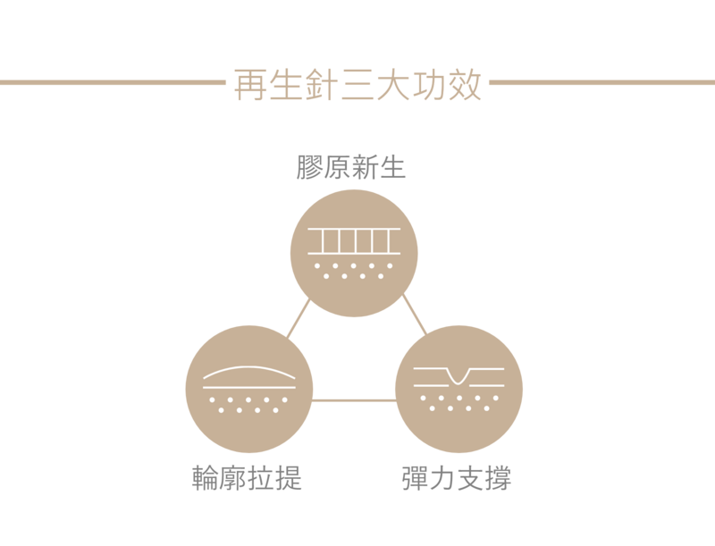再生針（Radiesse），又稱再生針、新一代微晶瓷、瑞得喜，來自德國 Merz 製藥大廠。