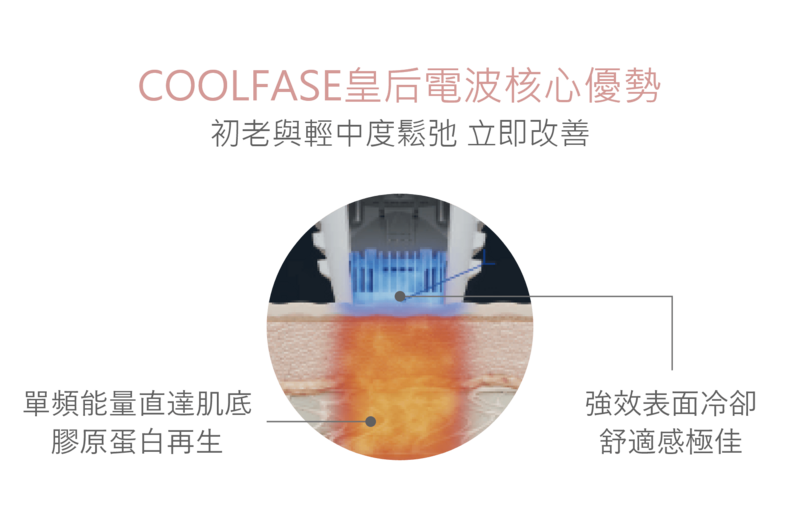 Coolfase皇后電波儀器,新一代無痛電波拉提