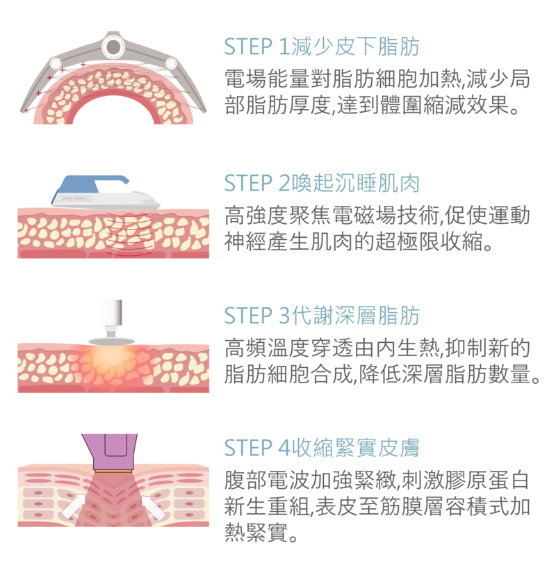 增肌減脂四部曲療程以不同的原廠機達成多重功效；第一步，減少皮下脂肪，電場能量對脂肪細胞加熱，減少局部脂肪厚度，達到體圍減縮效果。第二步，喚起沉睡肌肉，高強度聚焦電磁場技術，促使運動神經產生肌肉的超極限收縮。第三步，代謝深層脂肪，高頻溫度穿透由內生熱，抑制新的脂肪細胞合成，降低深層脂肪數量。第四步，收縮緊實皮膚，腹部電波加強緊緻，刺激膠原蛋白新生重組，表皮至筋膜層容積式加熱緊實。