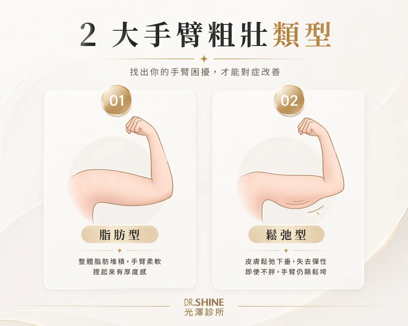 2 大手臂粗壯類型