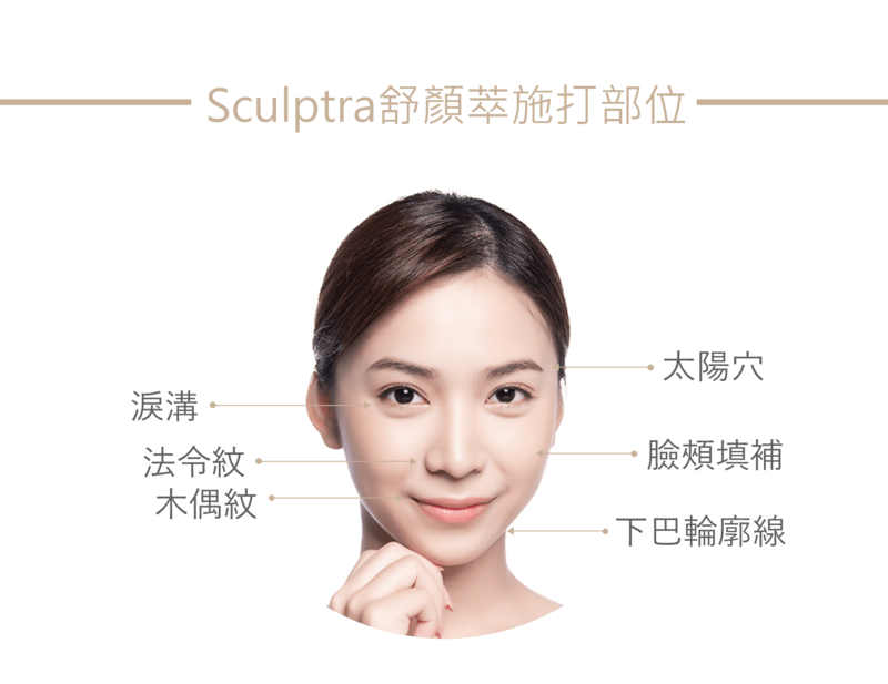 Sculptra（舒顏萃）依照施打的劑量，與注射的部位，可以達成不同的成效；太陽穴、淚溝、法令紋、木偶紋、臉頰填補、下巴輪廓線改善等，客戶可以在光澤診所諮詢時，和專業醫師詢問要改善的部位，進行客製化的微整療程。