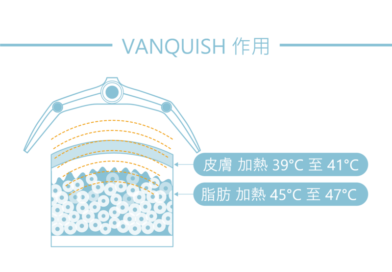 隔空減脂Vanquish儀不必接觸身體，針對局部脂肪層過厚(肥胖)的部位，透過高頻電磁場加熱(皮膚加熱達39~41度、脂肪加熱達45~47度)，達到破壞皮下脂肪細胞，使脂肪細胞自然凋亡，讓身體自行代謝分解後的脂肪細胞，進而減少脂肪厚度及體圍。