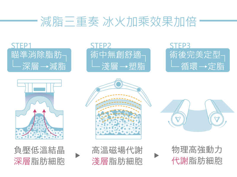 第一重冷凍減脂：先用負壓吸引深層脂肪，是利用脂肪細胞容易結晶化啟動細胞凋亡機制，一次有效減少25%脂肪層厚度。第二重隔空減脂：塑脂儀器，對準治療大部位，直接讓目標脂肪組織的溫度上升，有效持續加熱，溶解淺層脂肪還能緊緻肌膚。第三重LGP：利用動力輪軸和負壓吸引的搭配產生300多種不同的組合，讓深層脂肪跟淺層脂肪一起加速代謝，除了可以刺激淋巴循環，亦能雕塑身型。