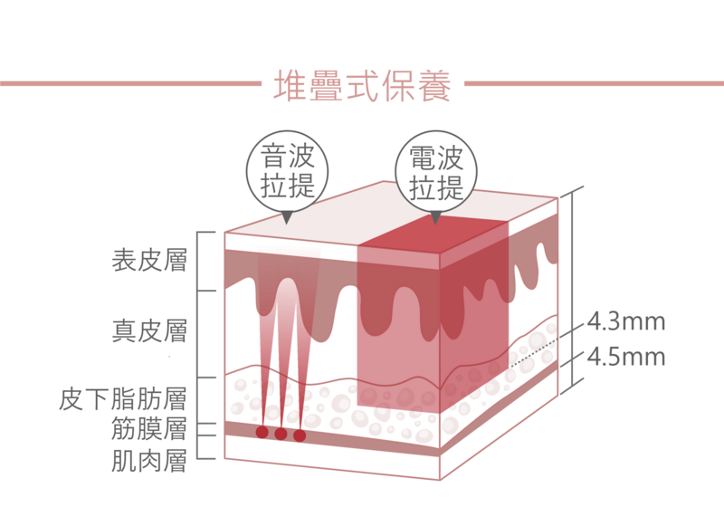 面部肌膚的老化、下垂、皺紋等困擾，是膠原蛋白在不同深度的肌膚組織隨時間流失，產生的一系列肌膚鬆弛現象；因此搭配音波與電波的雙效拉提，可以作用在不同的肌膚深度，進而改善鬆弛現象。音波拉提可聚焦深入達筋膜層，而電波拉提則是深達真皮層與脂肪層進行容積式加熱，兩種療程交互作用，緊緻拉提的效果加顯而易見。