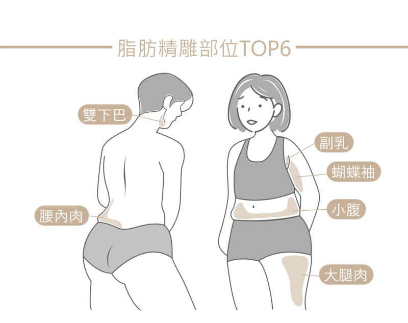 Ronkyla容脂針適用部位 Ronkyla容脂針適用部位示意圖,包含雙下巴、腰內肉、副乳、蝴蝶袖、小腹及大腿等局部脂肪改善部位。