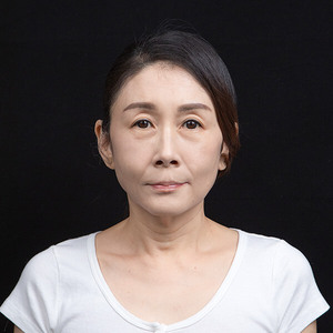 【名人見證】優雅逆襲！曲艾玲：與眼袋斷捨離，是我送給自己最好的禮物