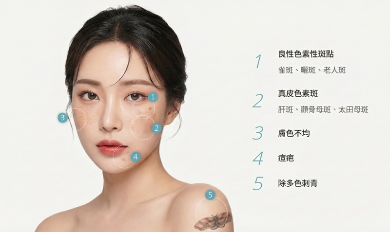 光澤診所推薦皮秒雷射，價格方案多方案比較