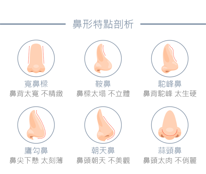 鼻型的特點與困擾，依照個人的骨骼結構與軟組織分布而有所差異；鼻背太寬使鼻樑看起來不精緻；鼻樑太塌形成不夠立體的鞍鼻；鼻背骨的駝峰，側面線條較為生硬；鼻尖太長而下懸，則會形成鷹勾鼻；或有朝天鼻讓鼻孔露出的困擾；鼻頭肥厚而肉多，則有蒜頭鼻困擾。為了改善不同的鼻型困擾，客製化的結構式隆鼻比傳統隆鼻成效較佳。