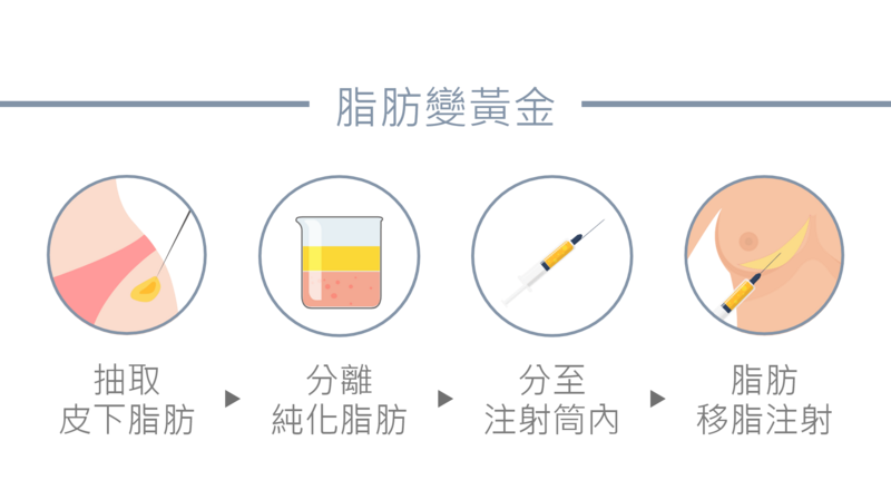 專業醫師施作自體脂肪隆乳手術的步驟，依序為抽取皮下脂肪(從腹部、臀部或大腿等處)；分離並且純化脂肪，獲得純淨的脂肪細胞；將脂肪分治注射筒內，使用細長的針頭進行多個小切口，然後輕輕注入脂肪細胞，增加乳房的大小和豐滿感。