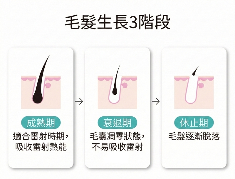 還在拔毛？一張表看懂為什麼要選「亞歷山大雷射」光澤診所推薦除毛首選