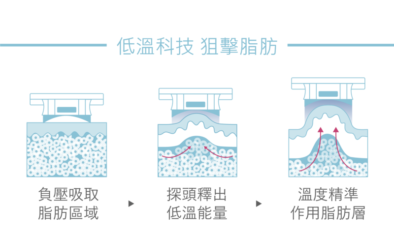 酷塑冷凍減脂療程是利用非侵入式的真空吸引探頭將組織吸入，準確傳遞精準控制的低温，讓脂肪細胞自然的凋亡；負壓吸取脂肪區域，探頭釋出低溫能量，溫度精準作用到脂肪層，進而達到減少局部皮下脂肪的效果。有局部肥胖困擾的客戶，可以向光澤診所的醫師洽詢冷凍減脂療程的可行性。 