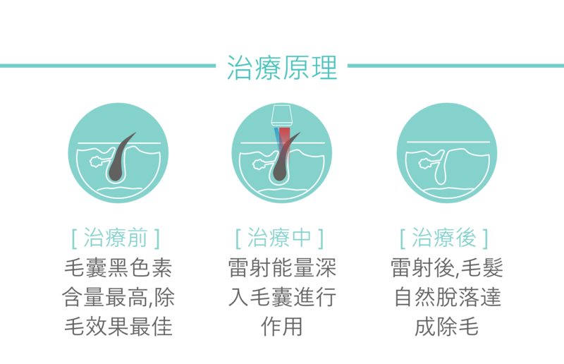 雷射除毛主要是藉由麥拉寧當介質吸收雷射光束後，產生光熱效應並傳遞足夠的熱能給毛囊母細胞，造成母細胞的凋零死亡，進而達到永久除毛；雷射除毛針對的是在生長期的毛髮，毛囊黑色素含量最高，除毛效果最佳。