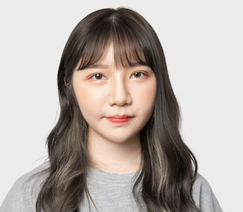 客製化的雙眼皮+提眼瞼肌手術，讓小薰擺脫提眼瞼肌無力與無神內雙，展現自信與魅力