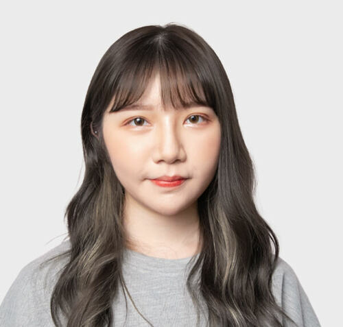 客製化的雙眼皮+提眼瞼肌手術，讓小薰擺脫提眼瞼肌無力與無神內雙，展現自信與魅力