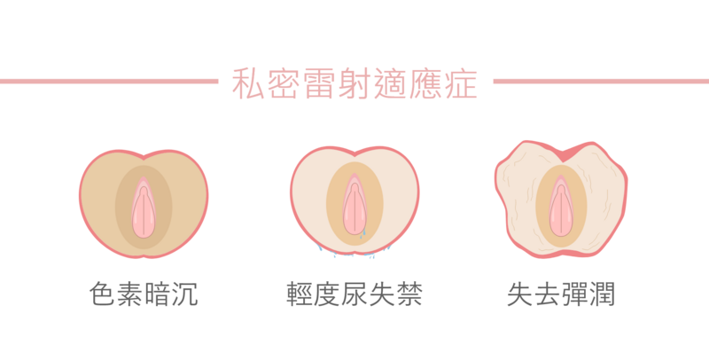 若您有以下困擾，可預約光澤診所洽詢私密雷射療程；產後陰道或陰唇鬆弛變形、輕度尿失禁、更年期陰道萎縮(失去彈潤)、性生活滿意度下降、私密處色素沉澱/暗沉。專業醫師將為您評估私密雷射的改善成效。