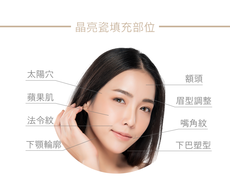 晶亮瓷填充部位示意圖，標示額頭、太陽穴、蘋果肌、法令紋、嘴角紋、下顎輪廓、下巴塑型與眉型調整等區域
