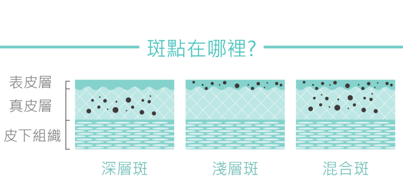 脈衝光療法(IPL)可以深入達真皮層，針對潛層斑點、深層斑點和色素沉澱進行改善；不同的波長也可以美白均勻膚色，增加皮膚彈性，改善酒糟膚質、血管擴張或泛紅肌。