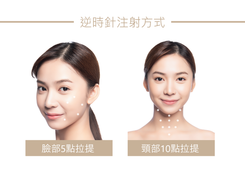 Profhilo逆時針BAP生物美學注射點，臉部五點注射與頸部十點注射示意圖，標示左右臉五個注射點位置，可以減少疼痛、降低瘀青腫脹並使效果均勻擴散，呈現療程舒適與自然提拉效果。
